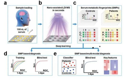 脑卒中快速诊断的革命性突破 中国学者引领的计算机辅助软硬件研发新纪元